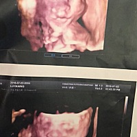 22周做的 哪位妈妈能看得出男女？