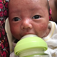 有宝妈知道这个是什么吗，看过好几个医生，擦过好几种药膏都没效果，求药方！！！