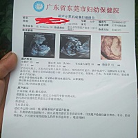 第一胎猜男女不管男女都好，纯属好奇心。