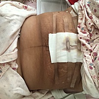 怀了个孕肚子就毁了。