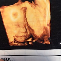 有人会看吗？是男是女？