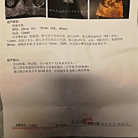 两个哥哥都希望有个小妹妹，求解这次的是不是小公举呢