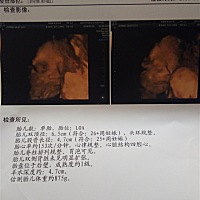 今天做了四维，宝宝很配合，一次就过了，大家帮忙看看是女孩男孩啊