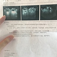 说宝宝不规则，发育不好，都建议我流掉，因为我抽烟喝酒，太自责了。一定要好好爱惜自己的身体