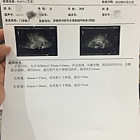 本来打算10月要孩子的，就想着去检查身体吧，结果查出来我是多囊，心好累，看来暂时孩子是要不了了，好...