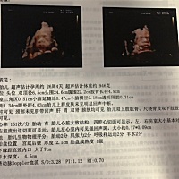 四维，看看男宝还是女宝呢！