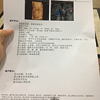 请各位帮忙看看宝宝像男宝宝还是女宝宝呢？谢谢