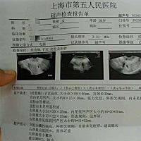 这是我舅妈的B超单之前做了两次试管婴儿但是都没成功 这次想下个月做意料之外自然怀孕了十几天查血 尿确...