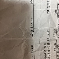 想问大家这个是怀了，还是没怀了，今天又来了血