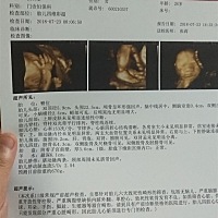 昨天做了4次，终于看到你的样子了。