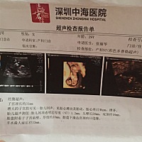 宝妈们有没有检查NT和我一样的，有点担心😓