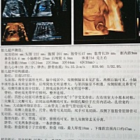 宝宝第一次四维！有会看男女的吗？欢迎留言