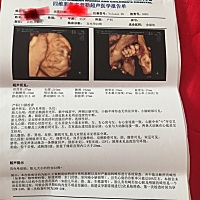 帮忙看看男女好奇