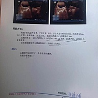 前天B超得出 19×17的卵泡 前天晚上和中午都有同房 昨天没有去B超也没有同房 今天B超得出已经排卵 那么...