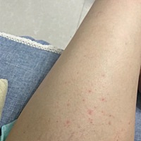 有大腿上长红点点的孕妈吗？最近几天我两边大腿上都长了这样的红点，也不痒，怎么回事啊？