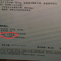 请问各位小姐姐，母体左肾积液是什么意思，严重吗，今晚左边有点痛。