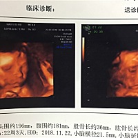 大家帮忙看看是男宝女宝呗😊纯属好奇