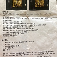 宝妈们能看出男宝还是女宝吗