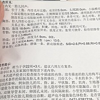 宝妈们帮我看看是男宝，还是女宝