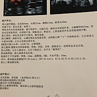 有看的懂的宝妈吗？