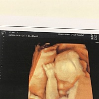 宝宝的手胖呼呼的，有点可爱、睡觉爱这个姿势有没有同款宝宝。