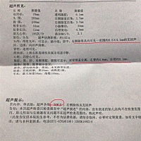 今天检查结果，血糖高，右侧脉络丛内无回声，有没有同样经历的宝妈，是怎么解决的，很焦虑心情低落，前...