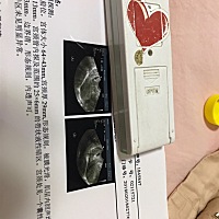 我怎么看不到我发的帖子，这是怀孕吗