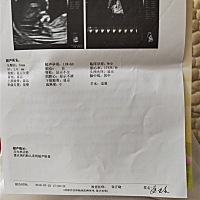 nt显示宝宝胎心174正常嘛