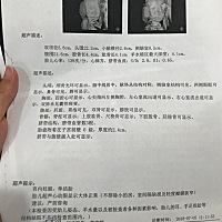 四维顺利通过！宝妈们，帮忙看看，人家说四维能看出男女，靠谱吗