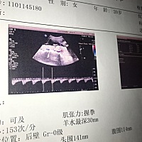 我家宝宝是男孩还是女孩？