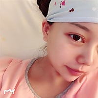 你们是母乳喂养吗？我感觉喂奶比手术都痛的厉害