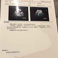 生完孩子后42天做B超 子宫内有残留物 需要刮宫吗？ 刮宫疼吗？ 有多疼？