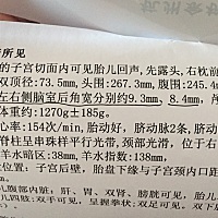 左右侧脑室超过10mm 就是脑积水了，有没有宝妈跟我一样的