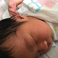 宝宝出生8天了，这两天脸上长了好多小疙瘩，月嫂说吃奶的时候热捂到了，自己就会好，不用管，有知道的宝...
