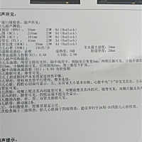 是男孩还是女孩