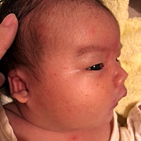 宝宝这两天长了好多小红点，是湿疹吗？