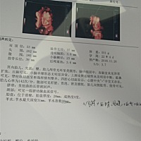 亲们，帮忙看一下是男孩还是女孩，有没有羊水少的，？