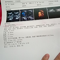 8月3号预产期  苏姓男宝宝  求大神帮忙取个好听的名字