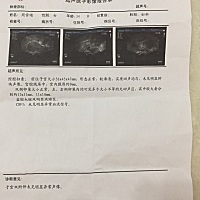 这个是我昨天做的排卵监测，月经开始的第十四天，这个正常吗？医生说没有优势卵泡了，已经排了，这里的...