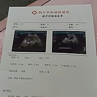 胎盘下缘达宫颈内口