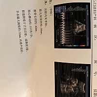 可以看出男女吗？ 大神们？