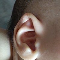 各位宝妈们，你们的宝宝会有这样的耳朵么，内肉都粘在一起了，还会长起来么，发愁啊，都59天了