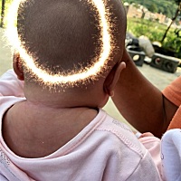 有没有宝宝后脑勺这样的、吃喝拉撒睡都好的、宝宝也和平时没区别、会不会是睡这样的呢、可不可以看看你...