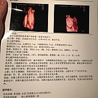 宝妈们有没有知道这种情况的：帆状胎盘，上个月照四维的时候医生说胎盘是这样的，不知道有没有什么危险...