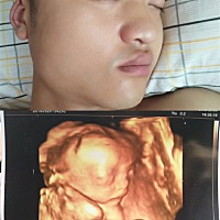 五个多月照的四维😋️😋️ 宝宝有没有太像宝爸了？