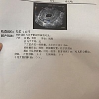第一次B超 能看出是男宝女宝吗？