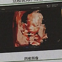秀宝宝 猜男宝女宝