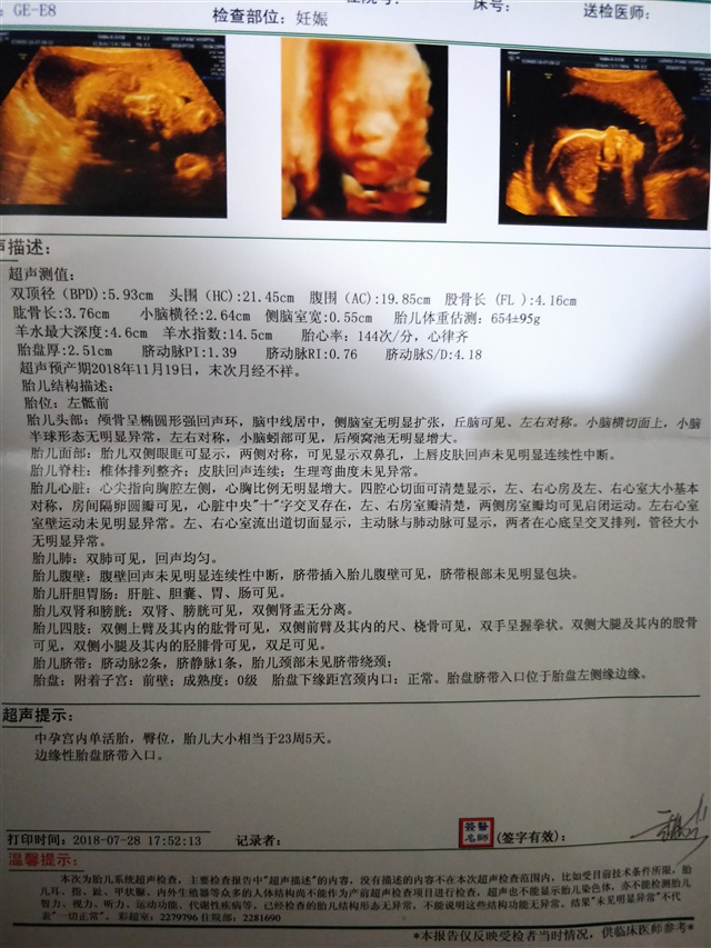 24四维
