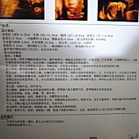 今天查的四维，有懂的能看出男女嘛？ 24四维