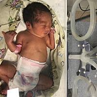 我家七喜宝宝平安到来，当天送去保温箱观察，需要一周，第二天开奶就晚了，都结了硬块，一天喊了两个疏...